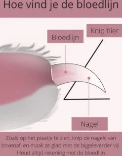 Professionele Nagelschaar | Nagelschaar Hond | Nagelschaar Kat | Nagelknipper Hond En Kat | Nagelknipper Kat| Nagelknipper Hond | NagelTang Dieren | Poot Verzorging -Honden Benodigdheden Verkoop 942x1200 3